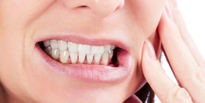چرا دندان ها زود به زود پوسیده می شوند؟