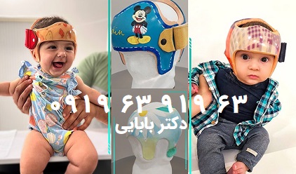 ملاج سر کجاست؟